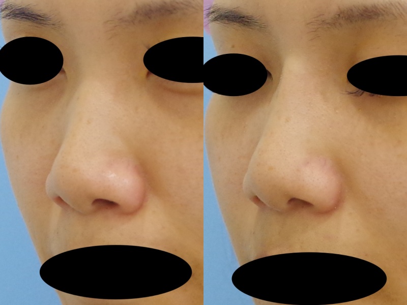 クレヴィエル 京都の美容外科 美容皮膚科 烏丸御池ビューティークリニック