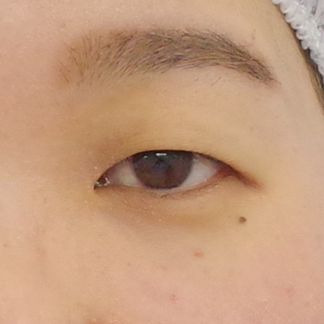 Before image