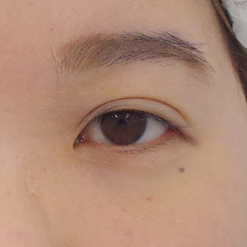 After image