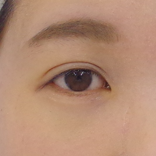 After image